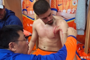 硬汉！记者晒卡扎尔受伤照，肩胛及上臂处多条血痕