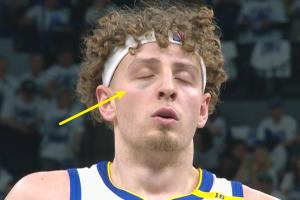 🐼波姐明显熊猫眼 为上一场对抗戈贝尔时受伤